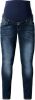 Noppies  Jeans Mena Plus dark stone wash Blauw Gr.42 Meisjes online kopen